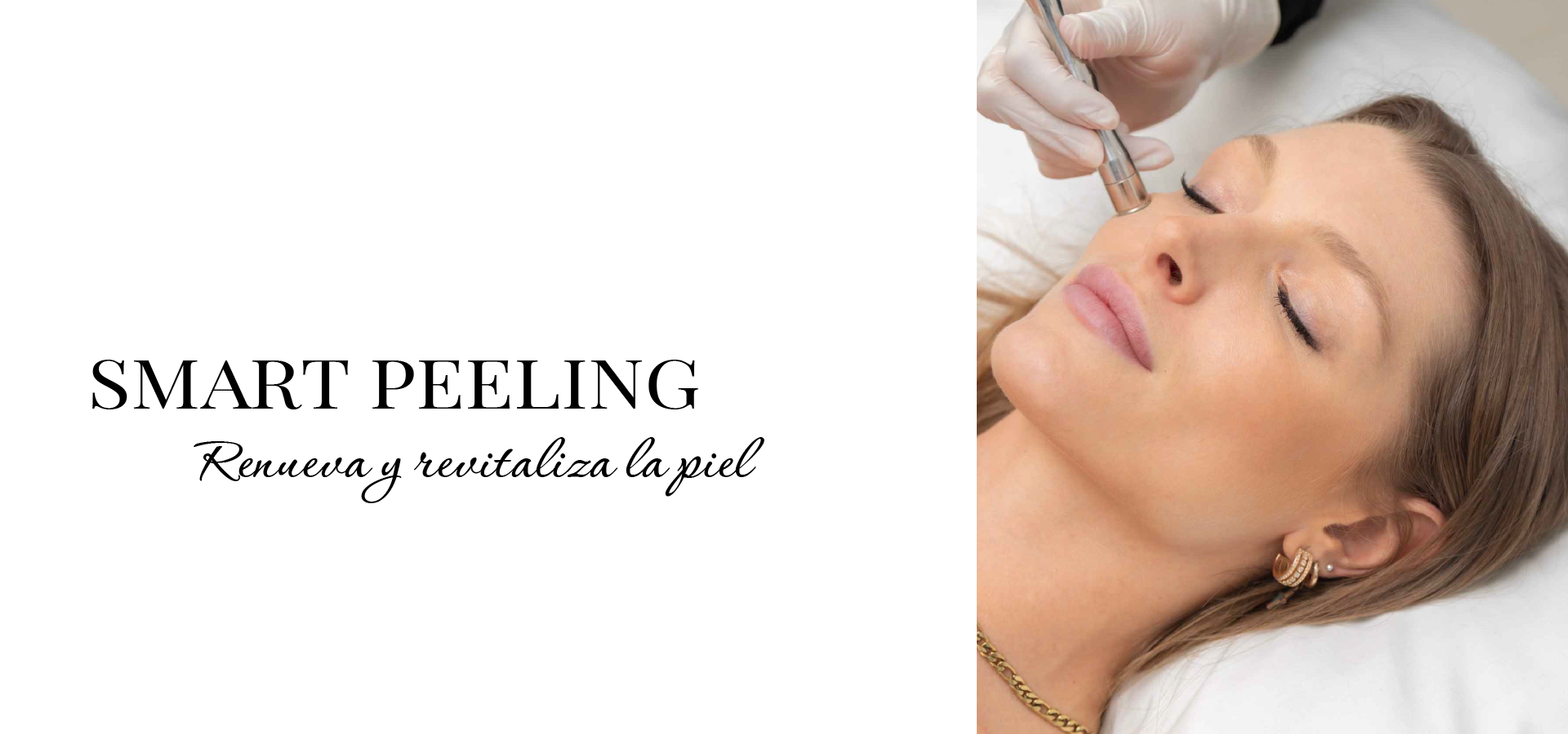 Smart Peeling - Skinny Lab Med Spa